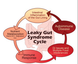Hashimoto's and Leaky Gut connection